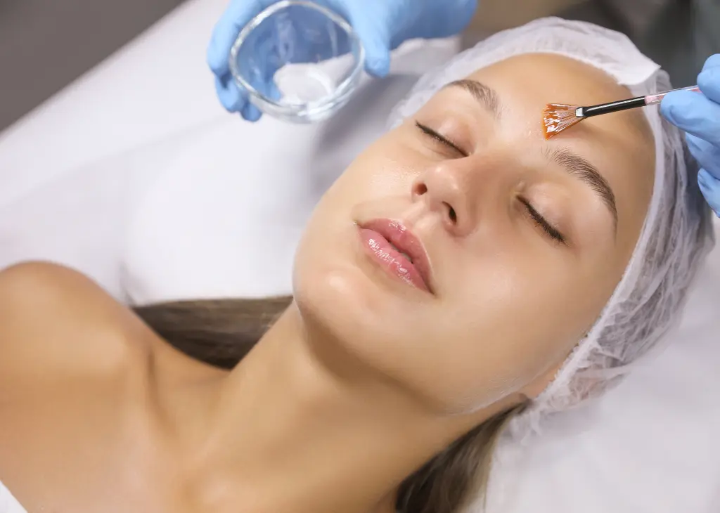 Peeling químico - Dra. Aline Barbosa